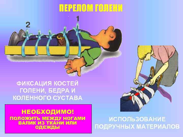 ПЕРЕЛОМ ГОЛЕНИ ФИКСАЦИЯ КОСТЕЙ ГОЛЕНИ, БЕДРА И КОЛЕННОГО СУСТАВА НЕОБХОДИМО! ПОЛОЖИТЬ МЕЖДУ НОГАМИ ВАЛИК