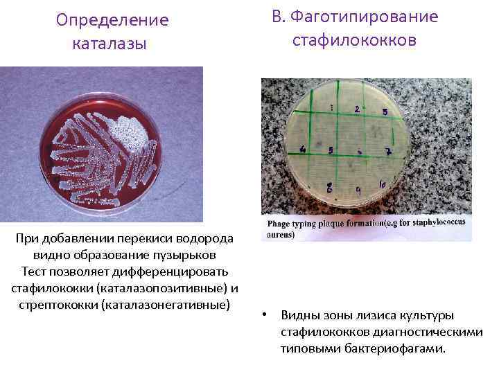 Определение каталазы При добавлении перекиси водорода видно образование пузырьков Тест позволяет дифференцировать стафилококки (каталазопозитивные)