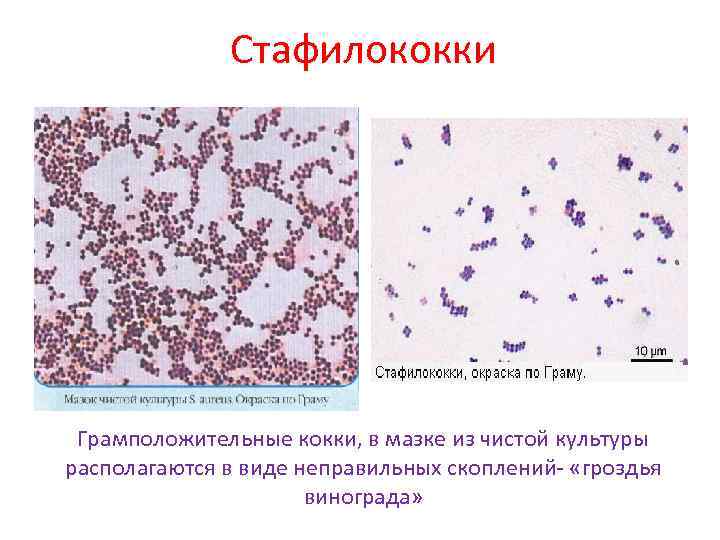Стафилококки Грамположительные кокки, в мазке из чистой культуры располагаются в виде неправильных скоплений- «гроздья