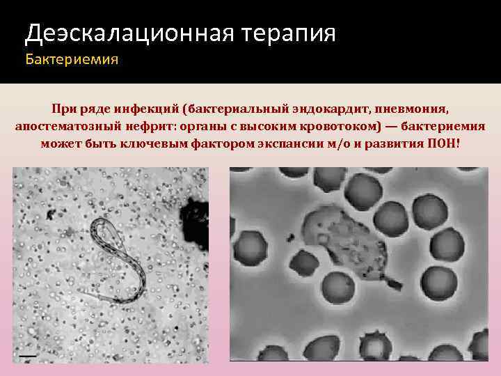 Деэскалационная терапия Бактериемия При ряде инфекций (бактериальный эндокардит, пневмония, апостематозный нефрит: органы с высоким