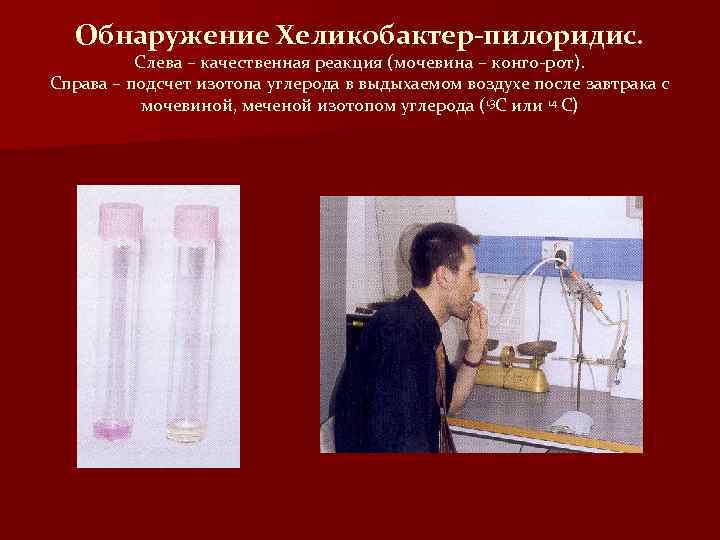 Обнаружение Хеликобактер-пилоридис. Слева – качественная реакция (мочевина – конго-рот). Справа – подсчет изотопа углерода