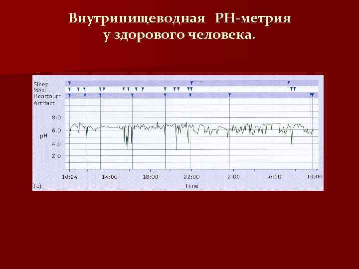 Внутрипищеводная РН-метрия у здорового человека. 