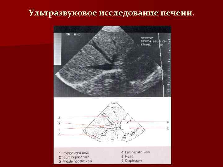 Ультразвуковое исследование печени. 