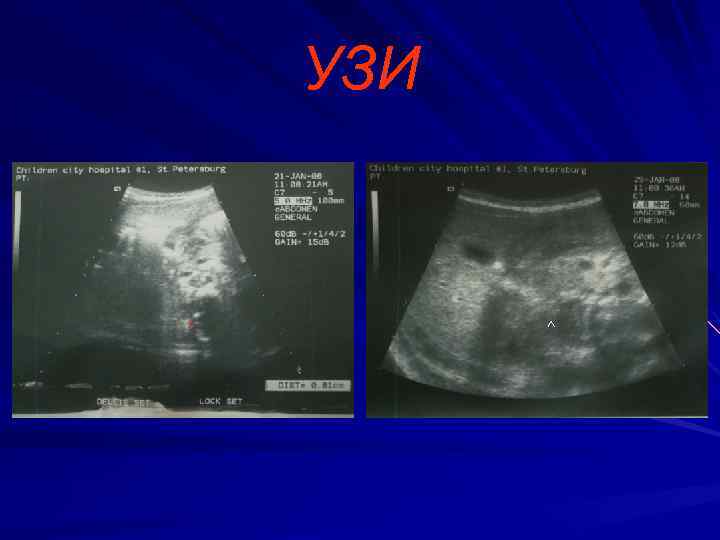 УЗИ ^ ^ 
