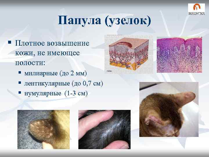 Чем обусловлен папиллярный рисунок кожи