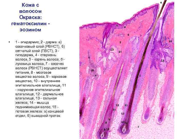 Кожа с волосом Окраска: гематоксилин эозином • 1 - эпидермис, 2 - дерма: а)