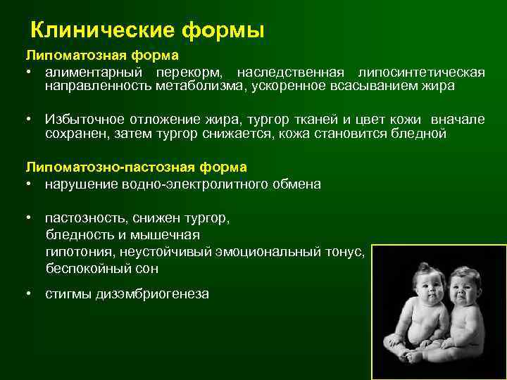 Клинические формы Липоматозная форма • алиментарный перекорм, наследственная липосинтетическая направленность метаболизма, ускоренное всасыванием жира