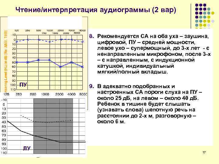 Чтение/интерпретация аудиограммы (2 вар) 8. Рекомендуется СА на оба уха – заушина, цифровой, ПУ