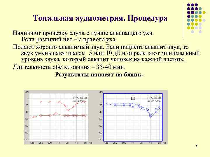 Тональная аудиометрия. Процедура Начинают проверку слуха с лучше слышащего уха. Если различий нет –