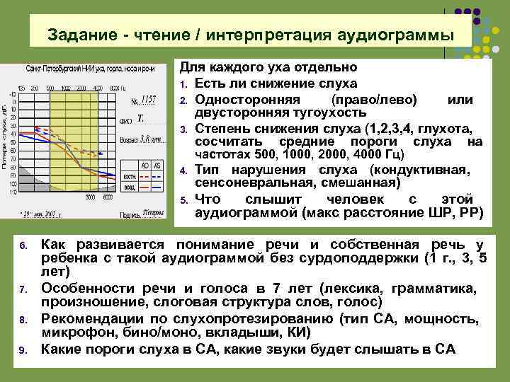 Задание - чтение / интерпретация аудиограммы Для каждого уха отдельно 1. Есть ли снижение