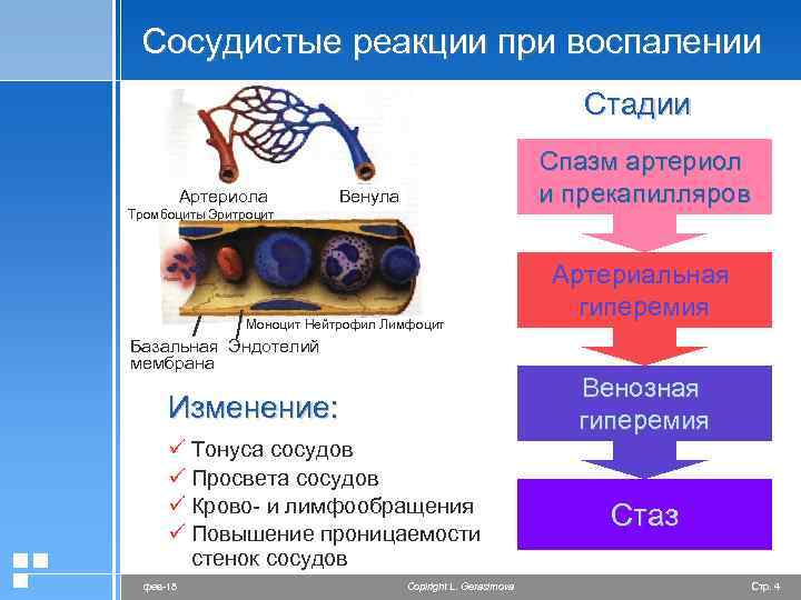 Сосудистые реакции при воспалении Стадии Артериола Спазм артериол и прекапилляров Венула Тромбоциты Эритроцит Моноцит