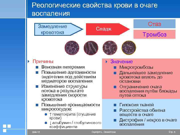 Реологические свойства крови в очаге воспаления Замедление кровотока Сладж 4 Причины < Венозная гиперемия