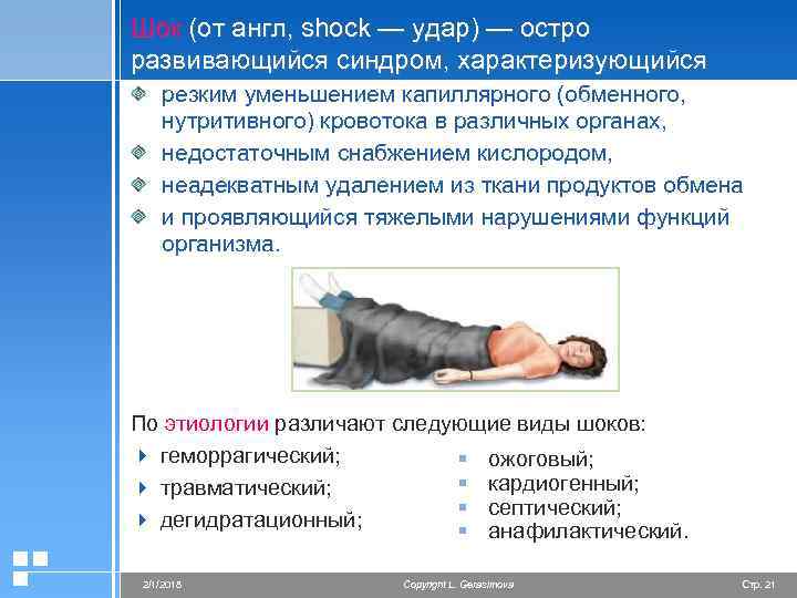 Шок (от англ, shock — удар) — остро развивающийся синдром, характеризующийся резким уменьшением капиллярного