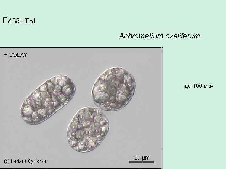 Гиганты Achromatium oxaliferum до 100 мкм 