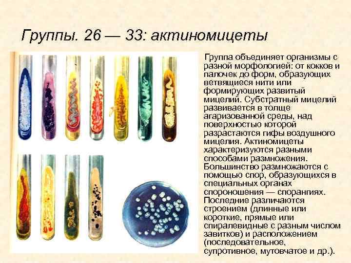 Группы. 26 — 33: актиномицеты Группа объединяет организмы с разной морфологией: от кокков и