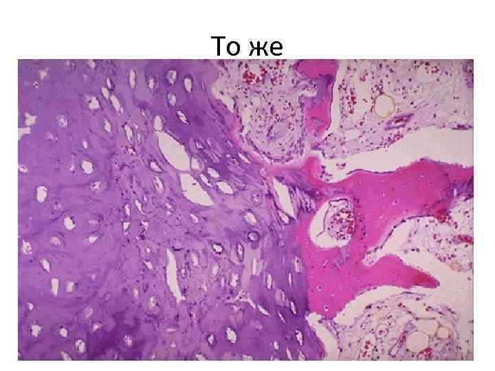 То же 