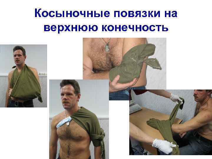 Косыночные повязки на верхнюю конечность 