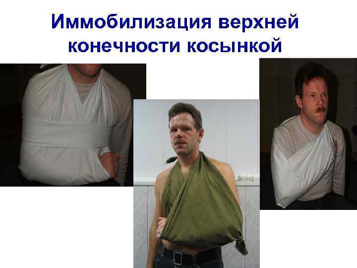 Иммобилизация верхней конечности косынкой 