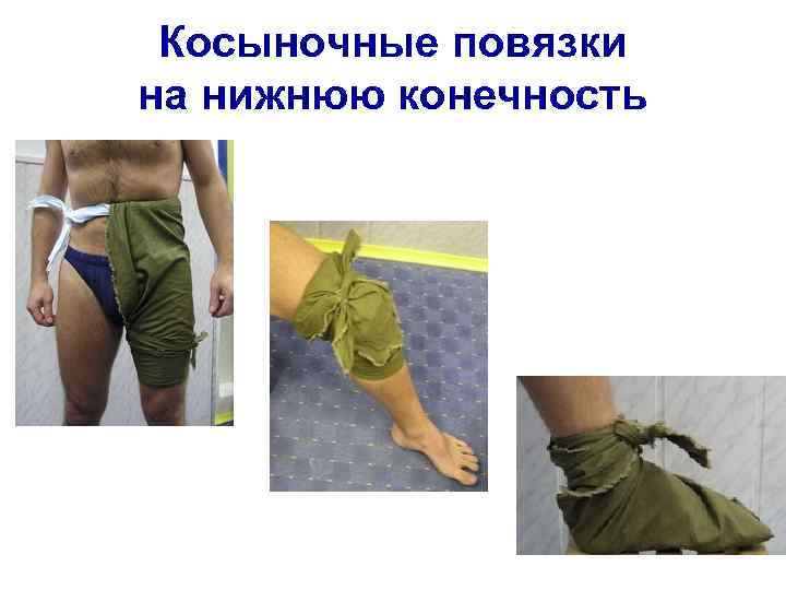 Косыночные повязки на нижнюю конечность 