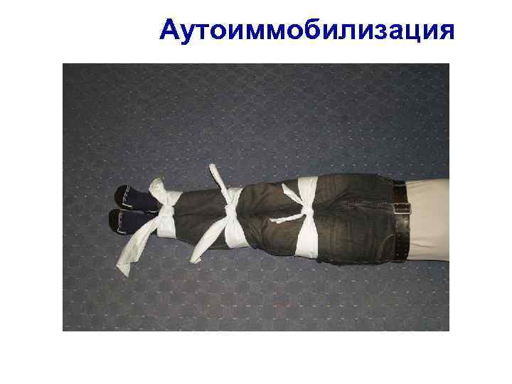 Аутоиммобилизация 