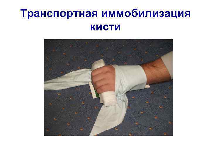 Транспортная иммобилизация кисти 