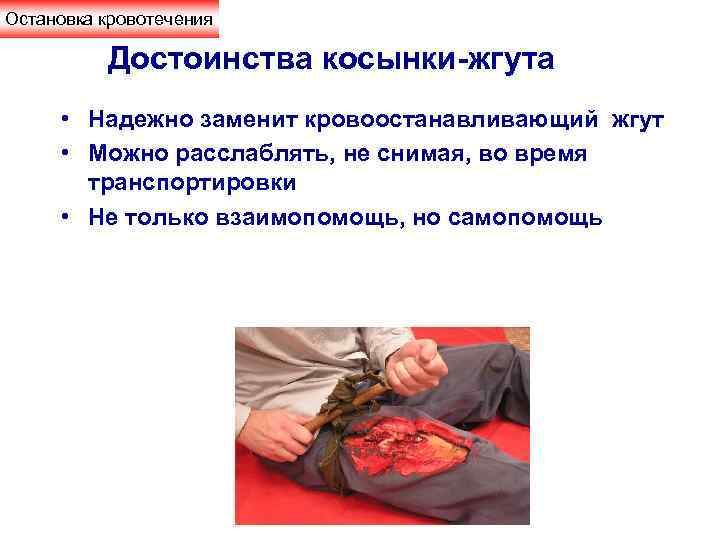 Остановка кровотечения Достоинства косынки-жгута • Надежно заменит кровоостанавливающий жгут • Можно расслаблять, не снимая,