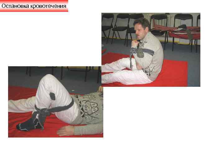 Остановка кровотечения 
