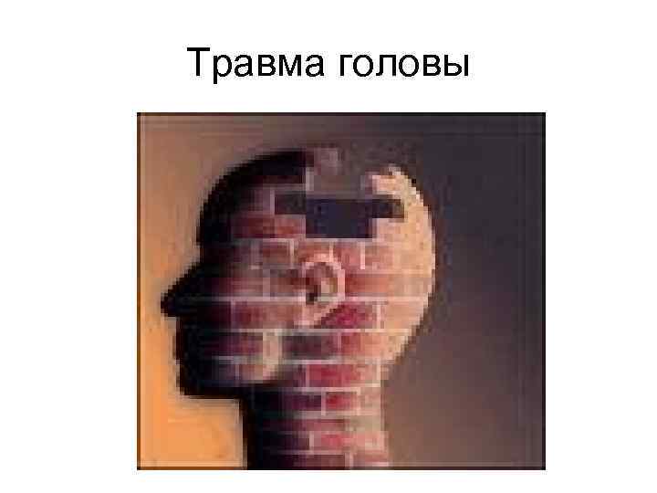 Травма головы 
