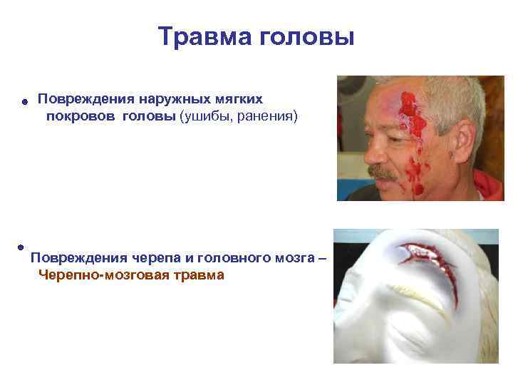 Травма головы Повреждения наружных мягких покровов головы (ушибы, ранения) Повреждения черепа и головного мозга