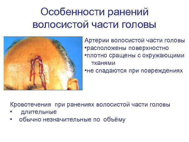 Особенности ранений волосистой части головы Артерии волосистой части головы • расположены поверхностно • плотно