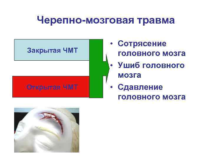Черепно-мозговая травма Закрытая ЧМТ Открытая ЧМТ • Сотрясение головного мозга • Ушиб головного мозга