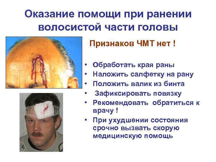 Оказание помощи при ранении волосистой части головы Признаков ЧМТ нет ! • • •