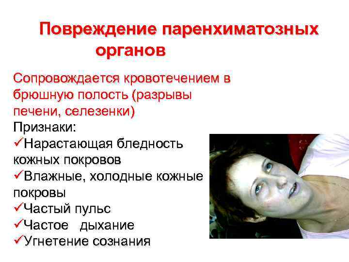 Повреждение паренхиматозных органов Сопровождается кровотечением в брюшную полость (разрывы печени, селезенки) Признаки: üНарастающая бледность