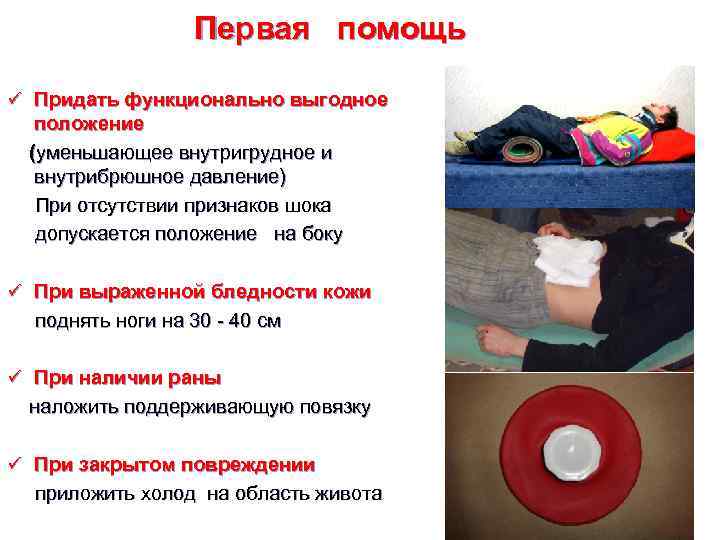 Первая помощь ü Придать функционально выгодное положение (уменьшающее внутригрудное и внутрибрюшное давление) При отсутствии