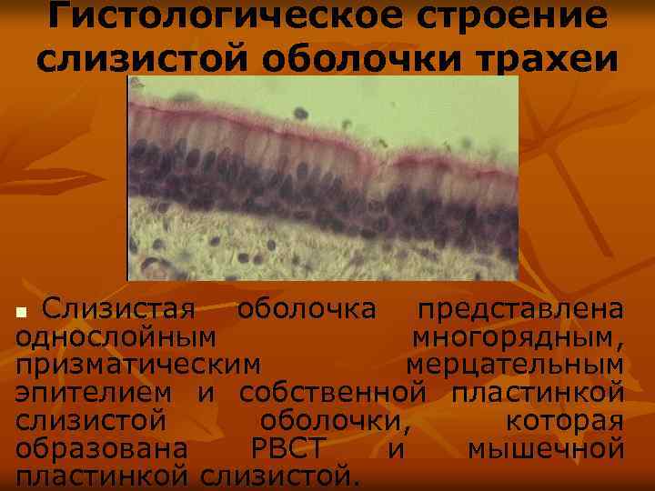 Гистологическое строение слизистой оболочки трахеи Слизистая оболочка представлена однослойным многорядным, призматическим мерцательным эпителием и