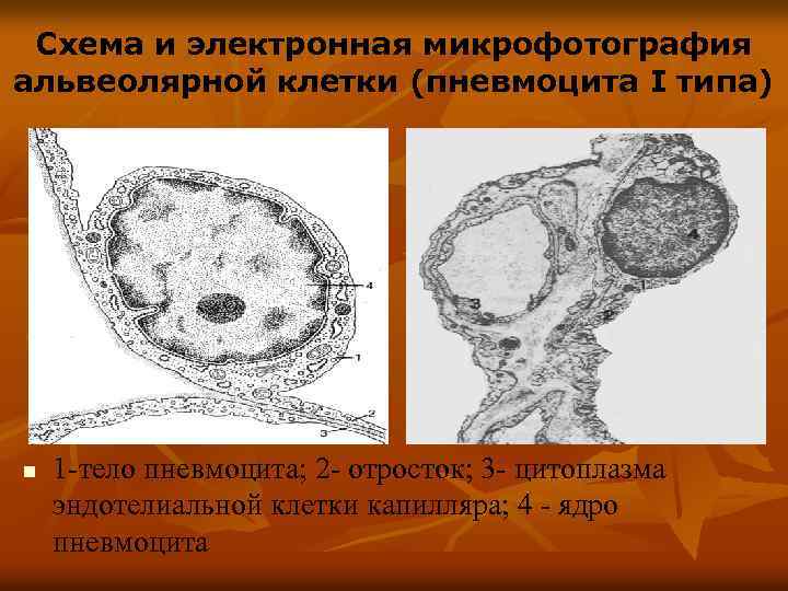 Схема и электронная микрофотография альвеолярной клетки (пневмоцита I типа) n 1 -тело пневмоцита; 2