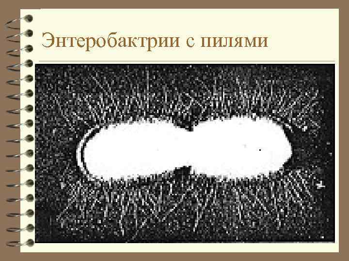 Энтеробактрии с пилями 
