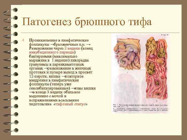 Патогенез брюшного тифа 4 Проникновение в лимфатические фолликулы →брызжеечные л. у. → Размножение через