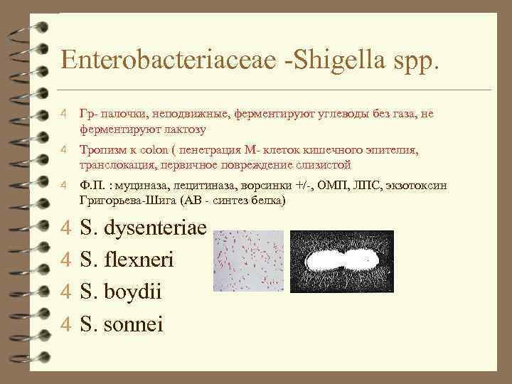 Enterobacteriaceae -Shigella spp. 4 Гр- палочки, неподвижные, ферментируют углеводы без газа, не ферментируют лактозу