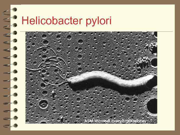 Helicobacter pylori 