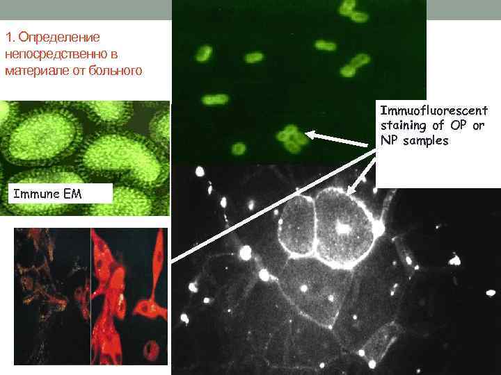 1. Определение непосредственно в материале от больного Immuofluorescent staining of OP or NP samples