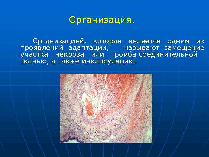 Отмирание тканей фото Волгоградский государственный медицинский университет Кафедра патологической ана