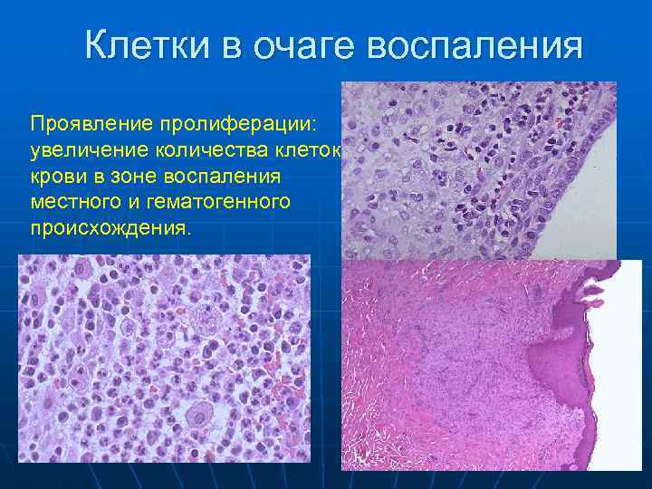 Клеточная пролиферация. Патологическая анатомия пролиферация. Пролиферация патанатомия. Фазы пролиферации патанатомия. Проявление пролиферации воспаления.