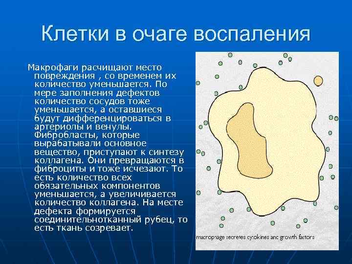 Клетки в очаге воспаления Макрофаги расчищают место повреждения , со временем их количество уменьшается.