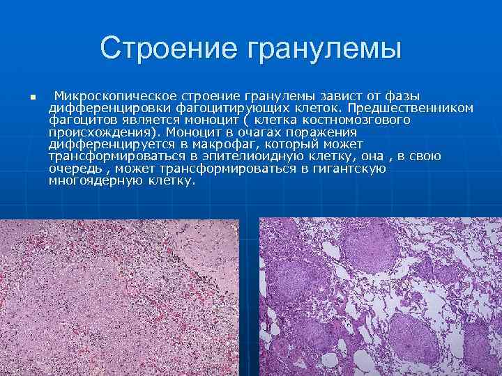 Строение гранулемы n Микроскопическое строение гранулемы завист от фазы дифференцировки фагоцитирующих клеток. Предшественником фагоцитов