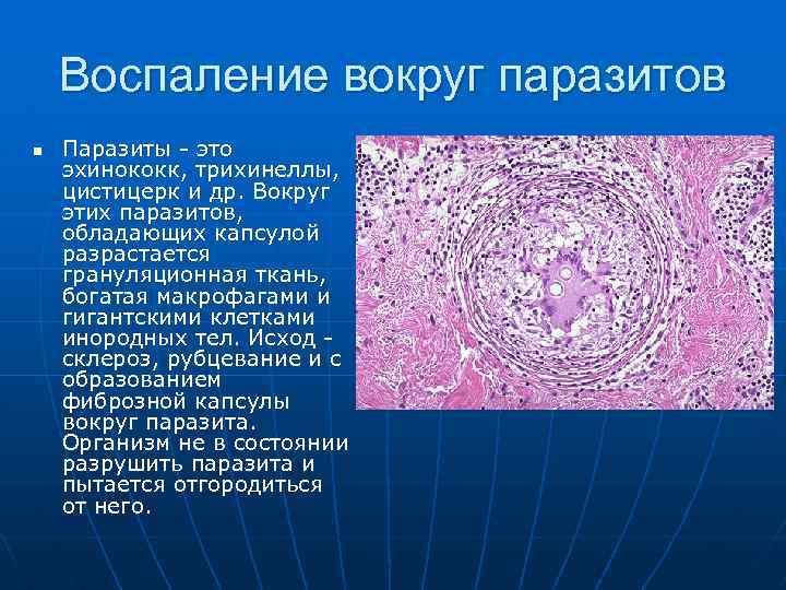 Воспаление вокруг паразитов n Паразиты - это эхинококк, трихинеллы, цистицерк и др. Вокруг этих