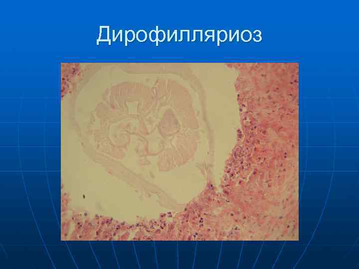 Дирофилляриоз 