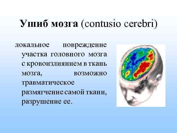 Ушиб мозга (contusio cerebri) локальное повреждение участка головного мозга с кровоизлиянием в ткань мозга,