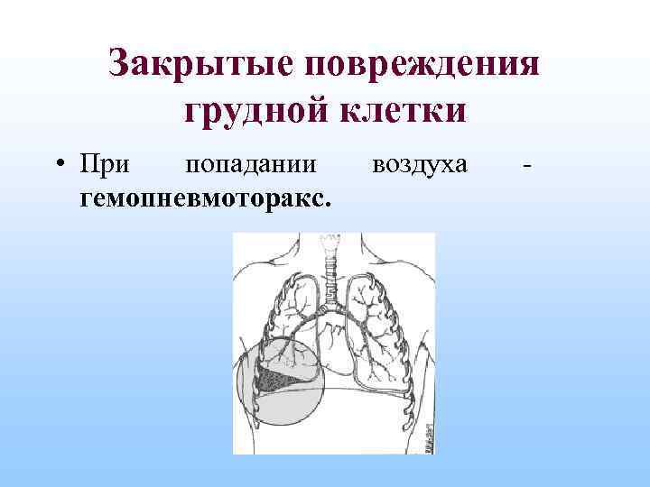 Закрытые повреждения