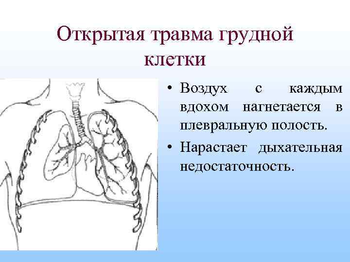 Поверхностная травма грудной клетки карта вызова